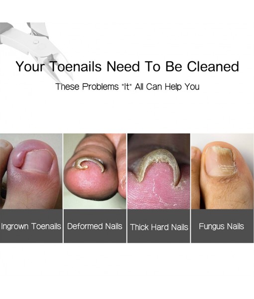 Ingrown Toenail clippers