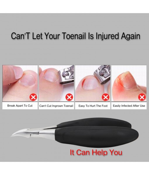 Ingrown Toenail clippers